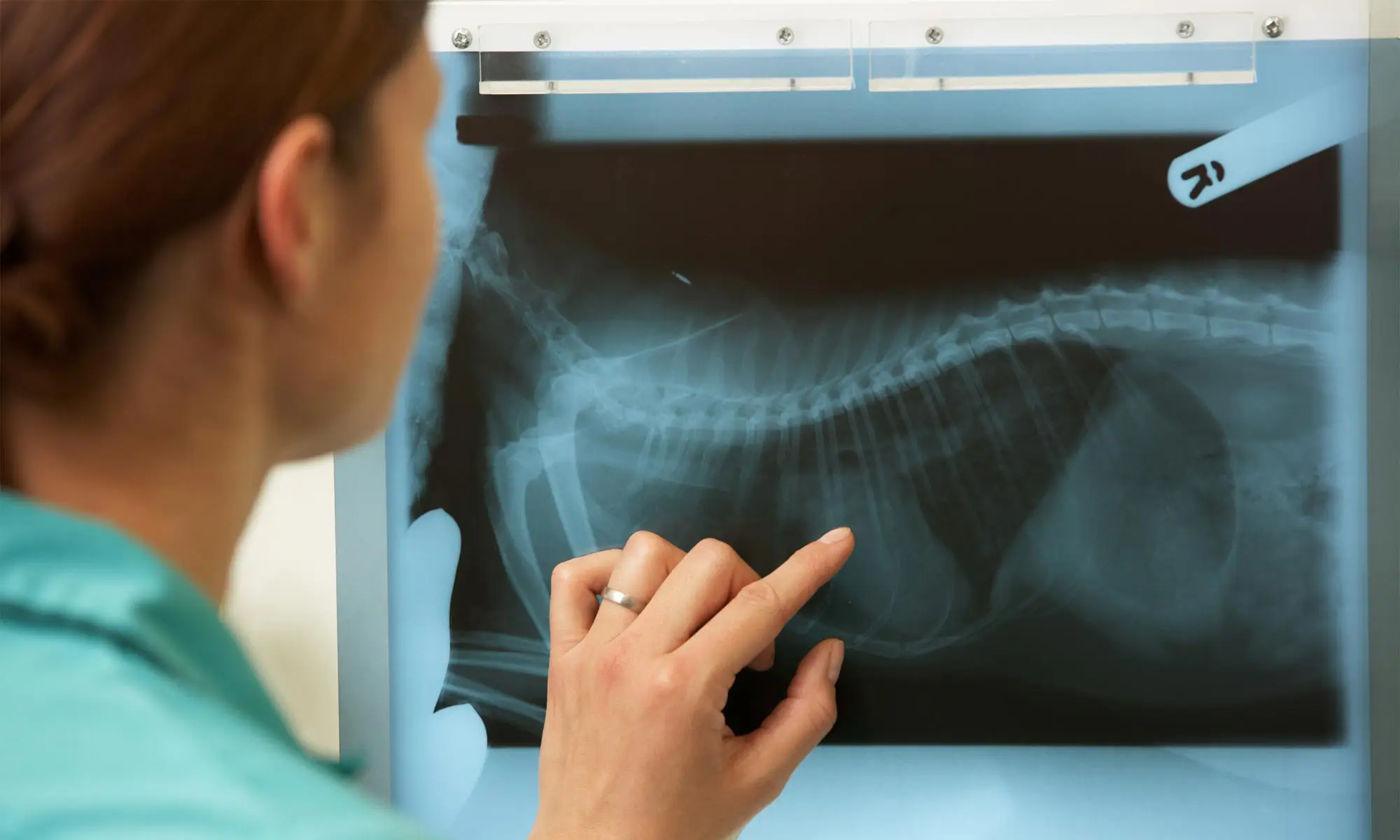 An X-ray
